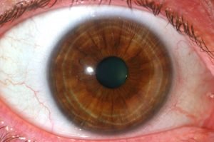 How Much Does Iridology Cost