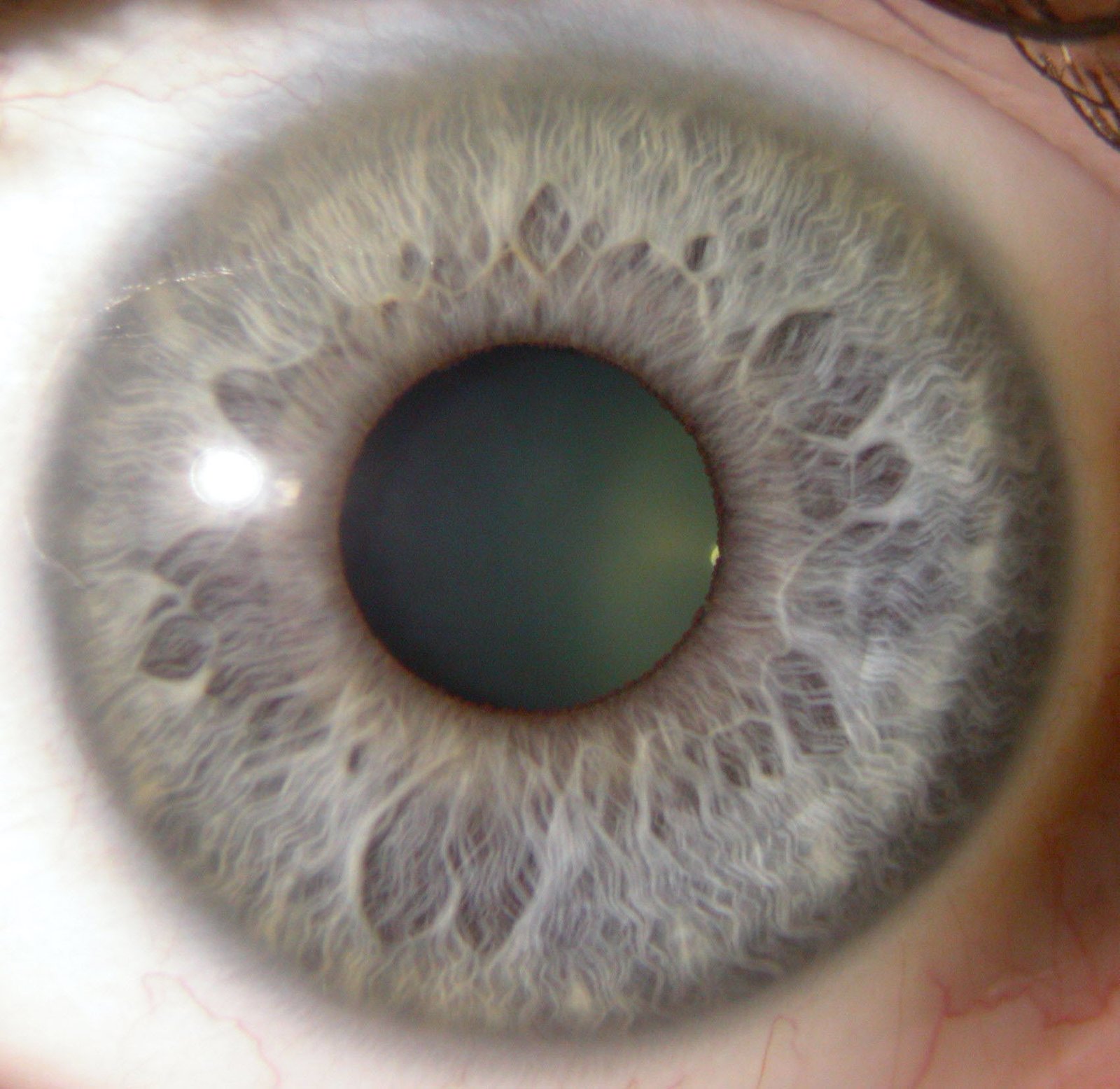 The History, Working Principle, and Applications of Iridology Cameras