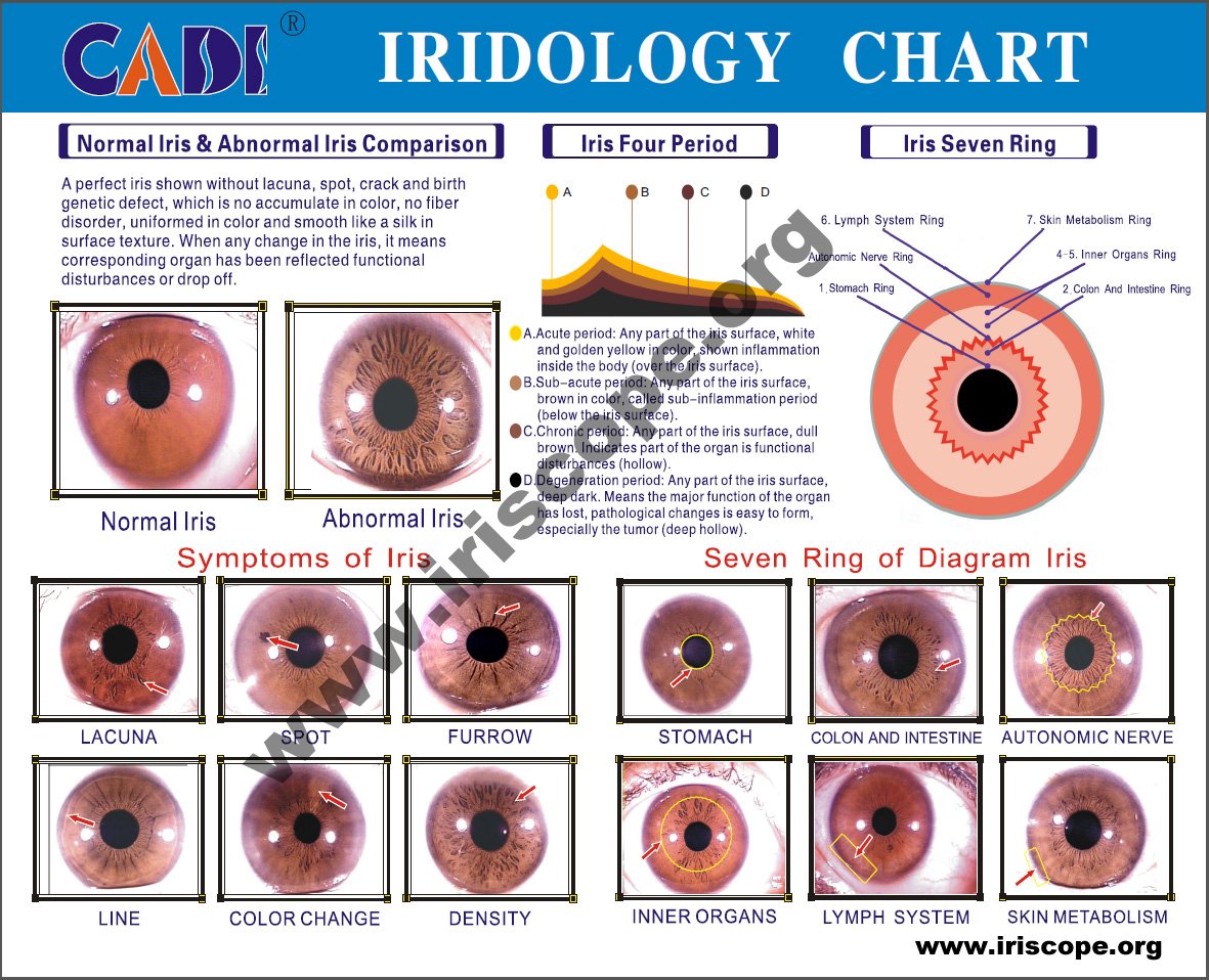 eye Iridology Chart iridology eye chart diagnosis