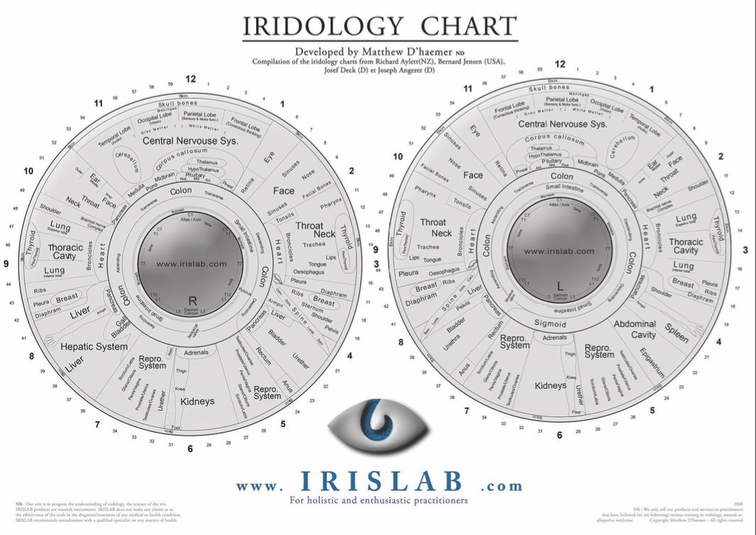 iridology chart left eye 2