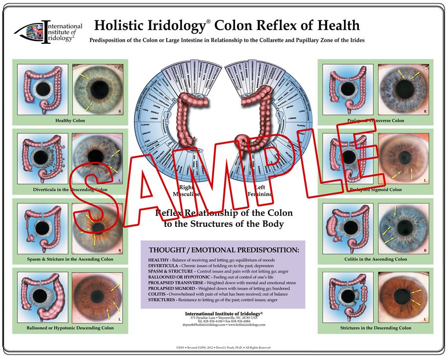 iridology eye chart diagnosis 18