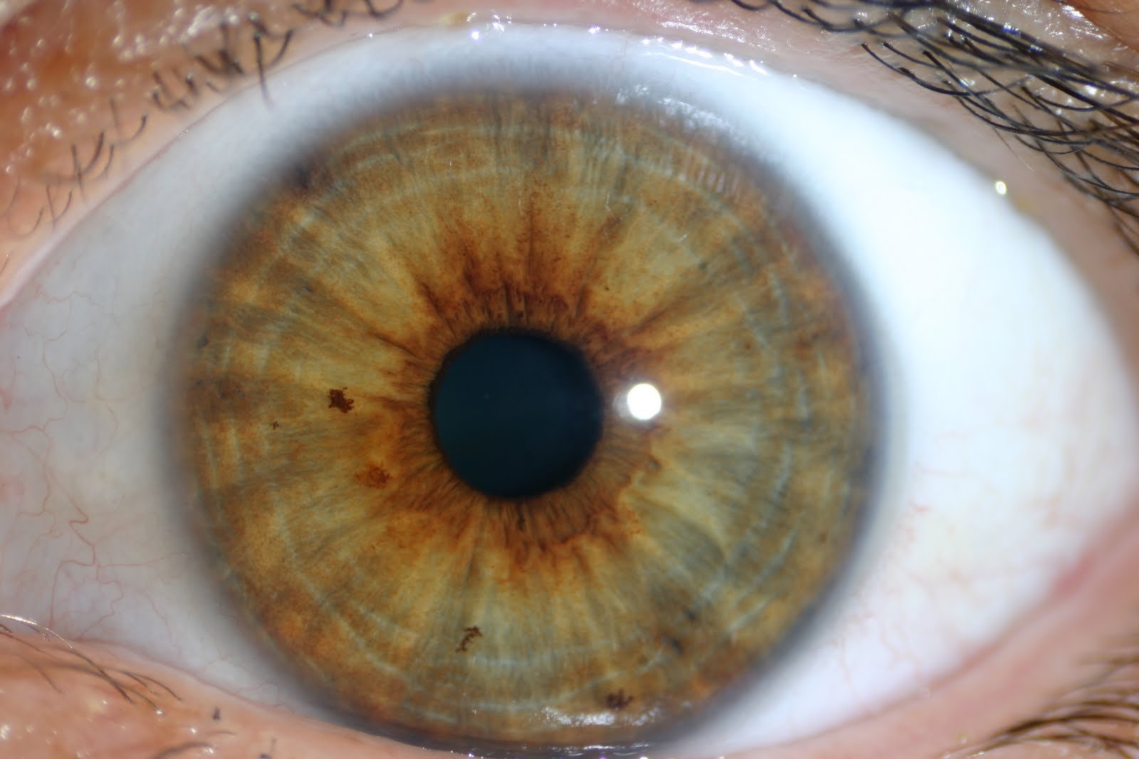 What Do You Use to Look at Eyes in Iridology?