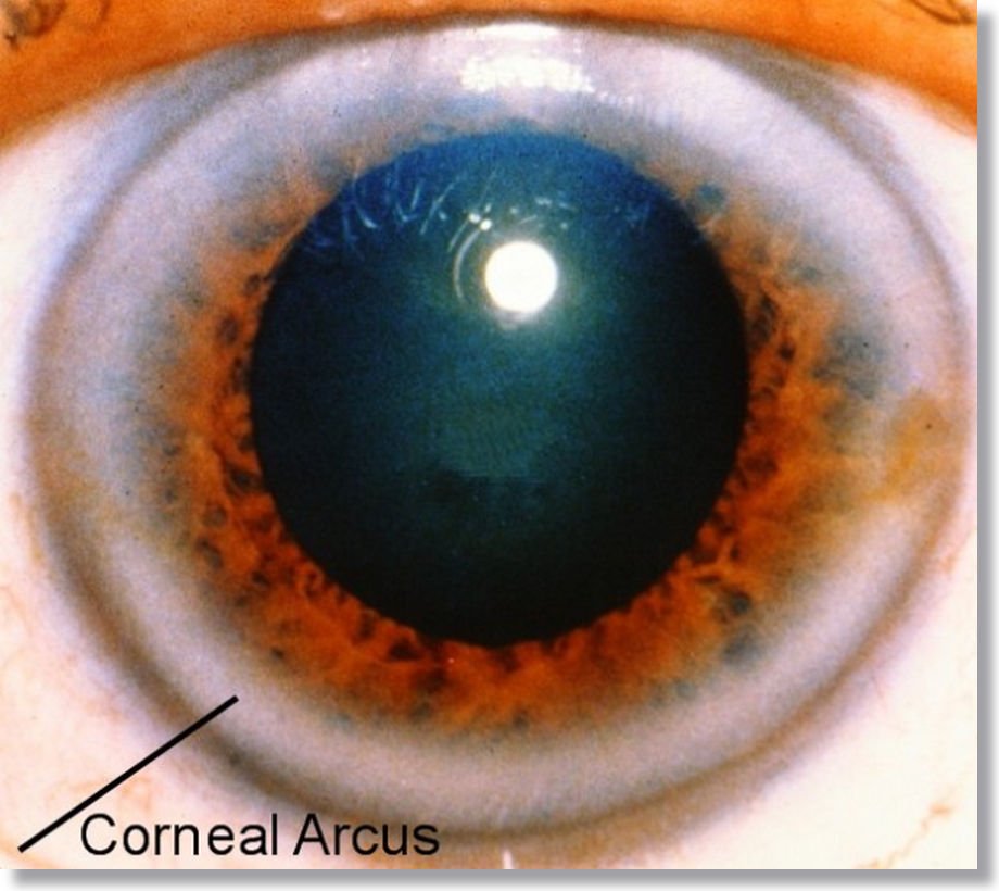 How Can You Read Emotions in Iridology?