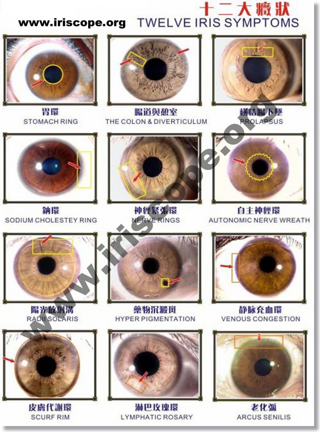 How Can You Read Emotions in Iridology?