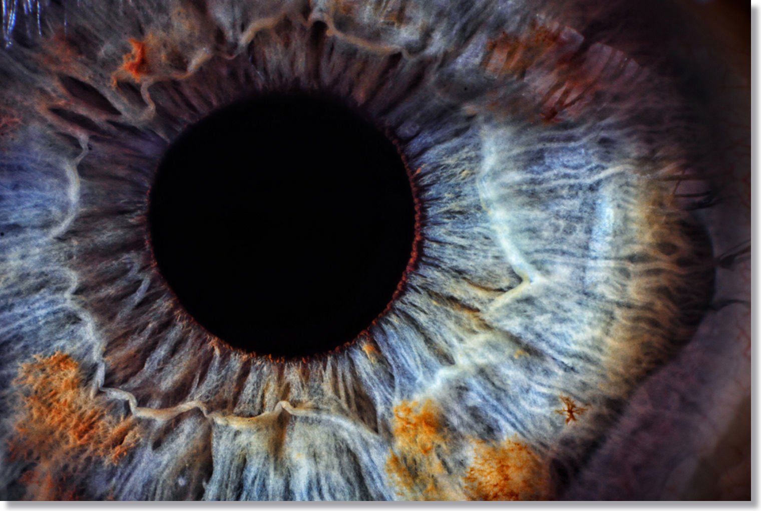 How Can You Read Emotions in Iridology?