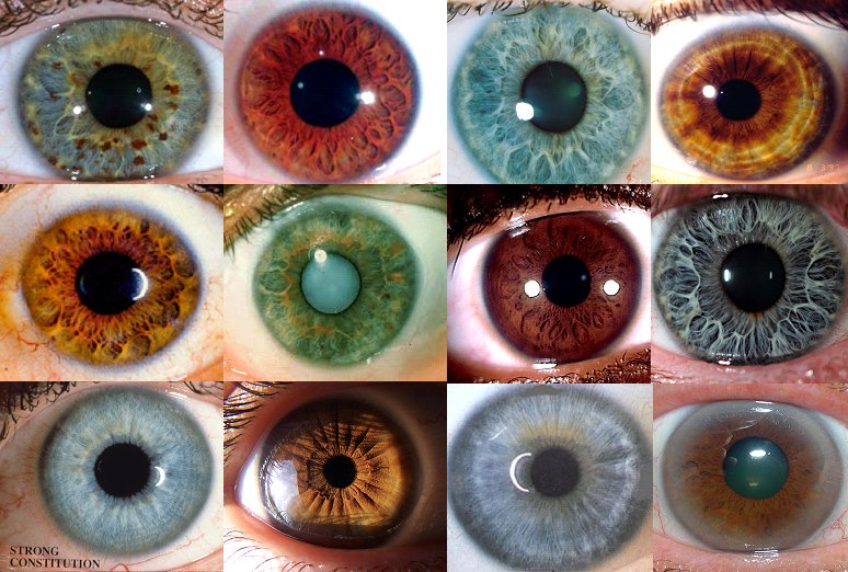 True Eye Color Iridology?