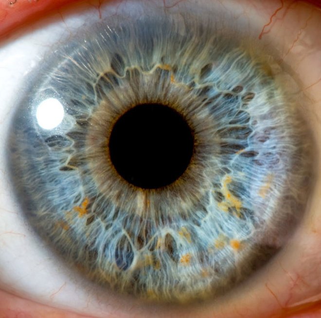 True Eye Color Iridology? Cosa rivela della tua salute