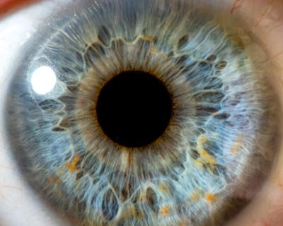 True Eye Color Iridology?