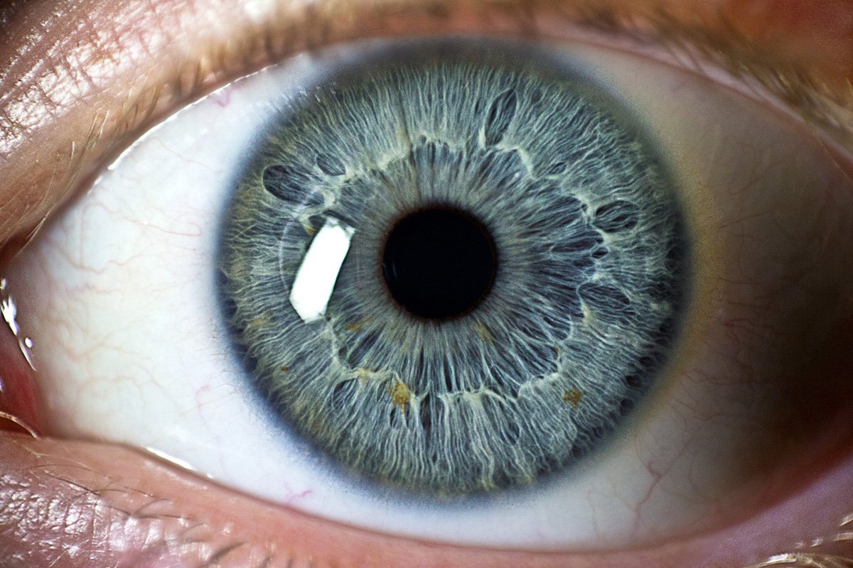 True Eye Color Iridology?