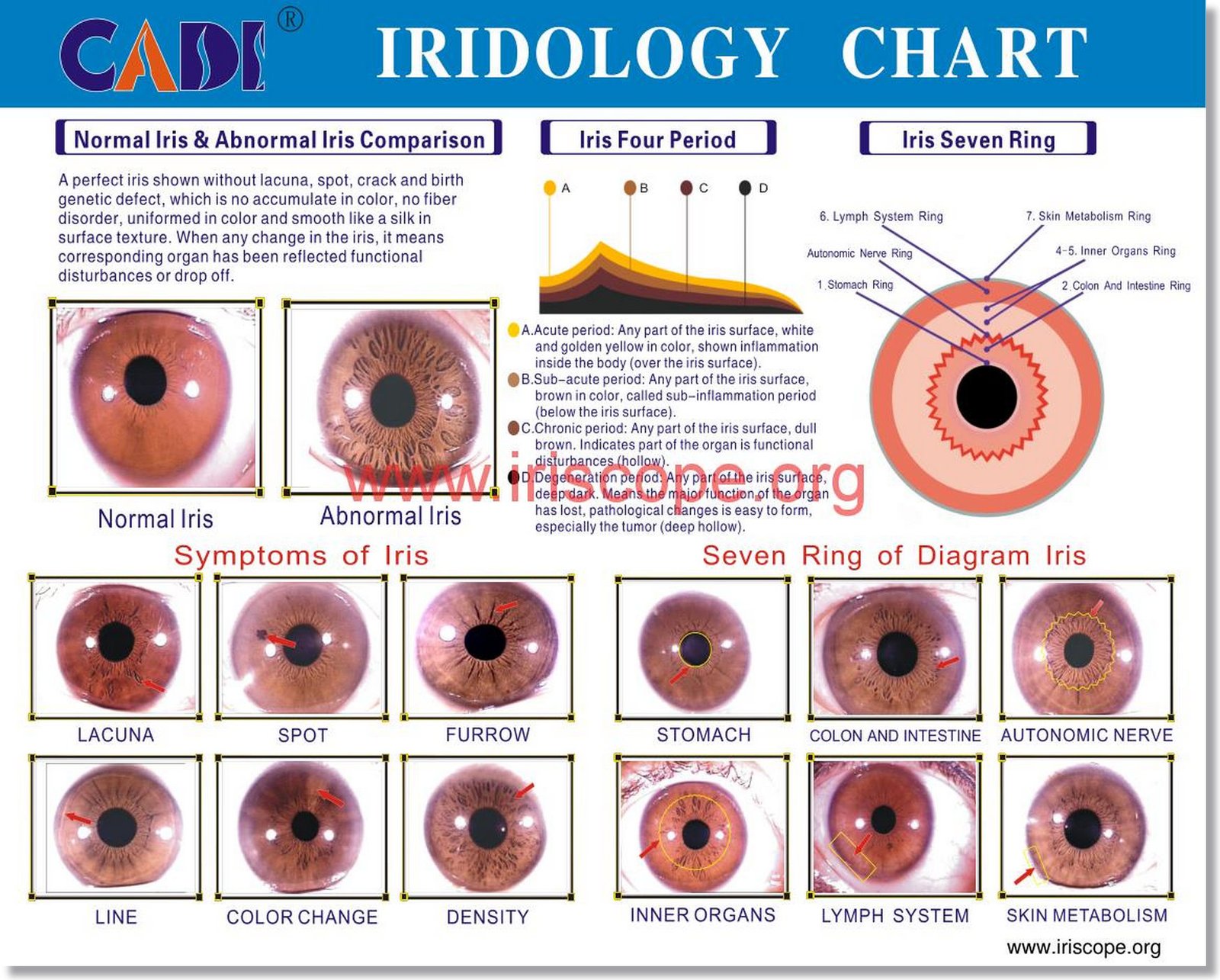 Iridology Color Analysis