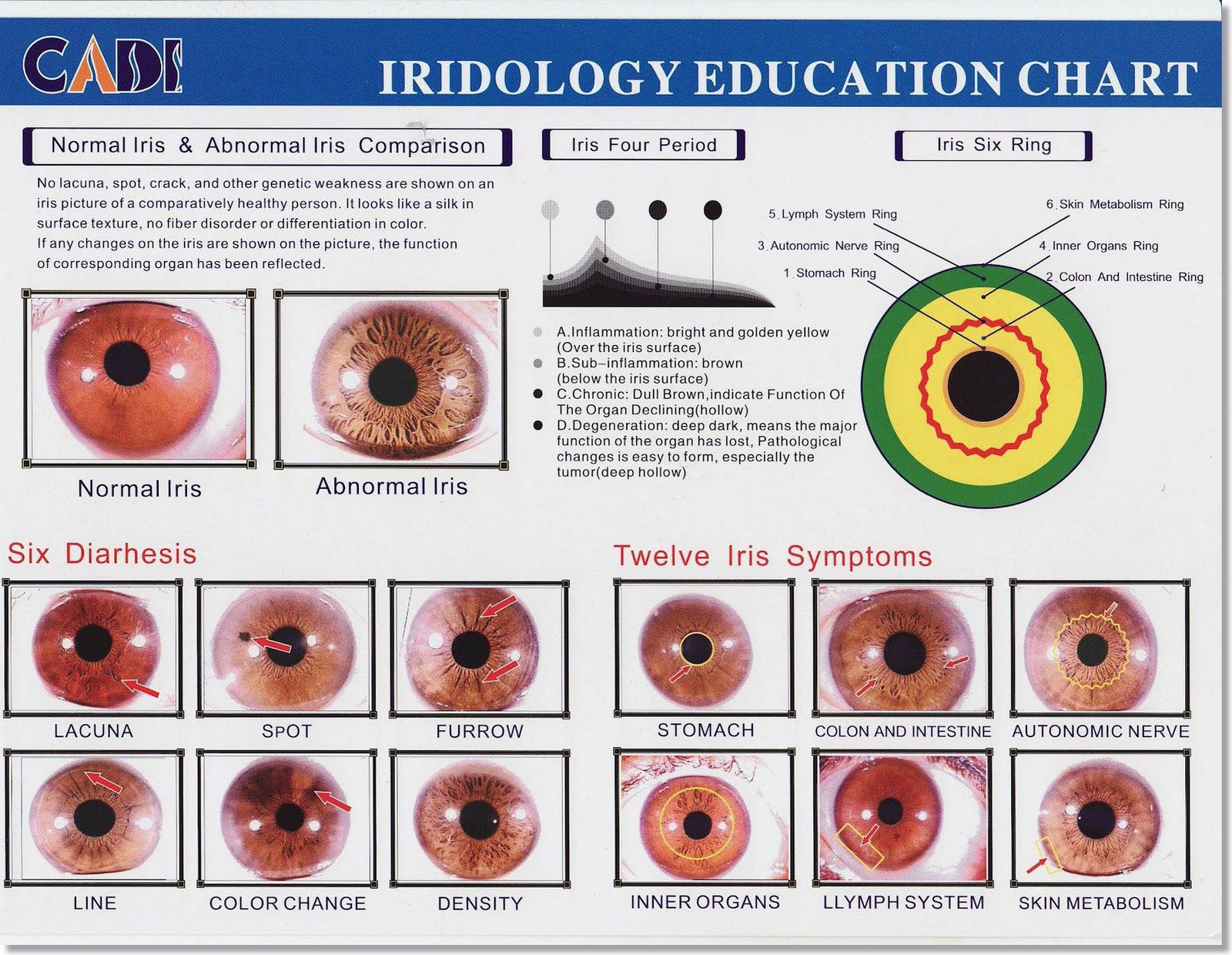 Iridology Color Analysis