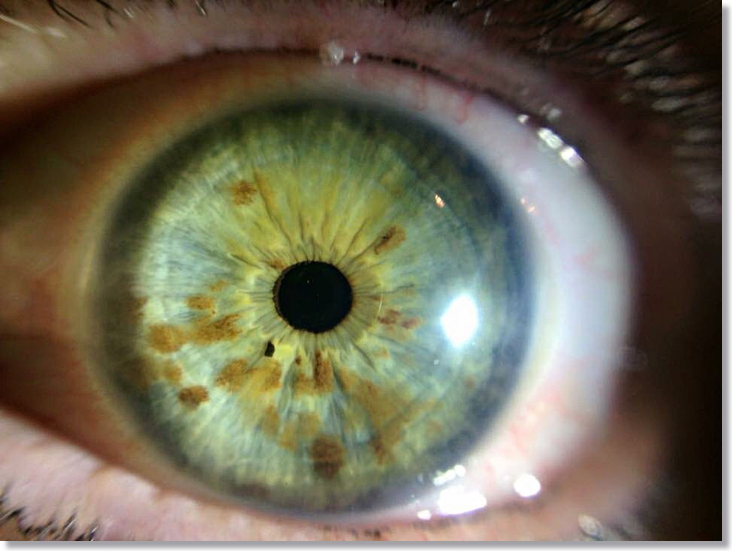 Iridology Change Eye Color? Insights from MAIKONG CO.LTD