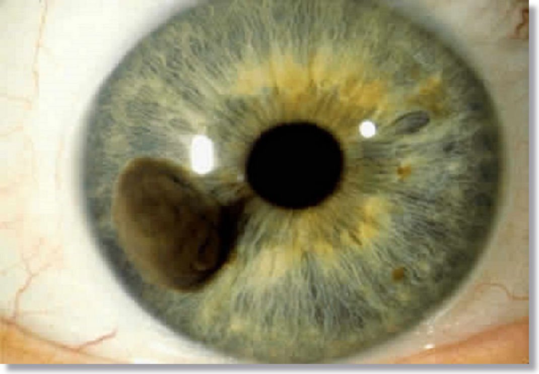 Iridology Change Eye Color? Insights from MAIKONG CO.LTD