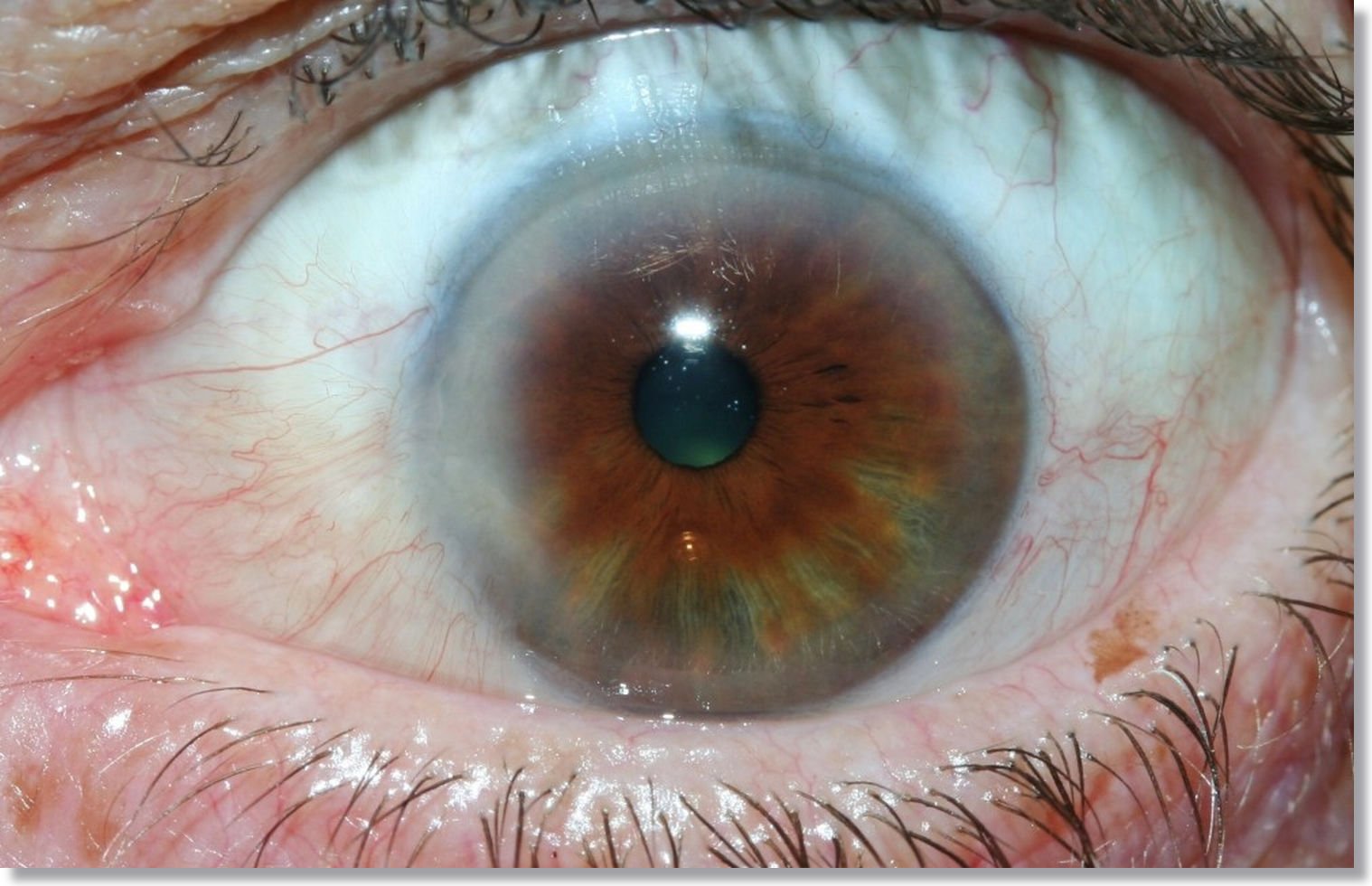 Iridology Change Eye Color? Insights from MAIKONG CO.LTD